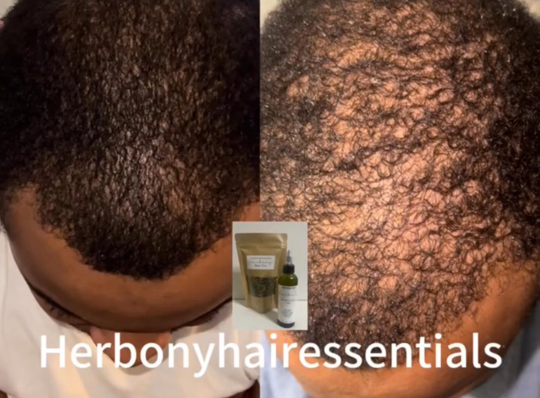 Hair Care Essentials to grow your hair found here ! – HERBONY HAIR ...